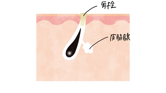 つまり毛穴とたるみ毛穴