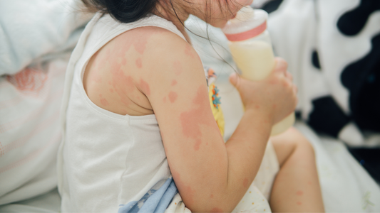 乳幼児期から更年期まで、肌あれ5パターン
